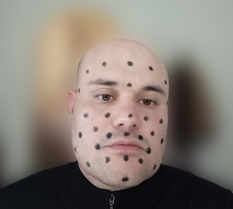 The author with skin-safe tracking marks on his face